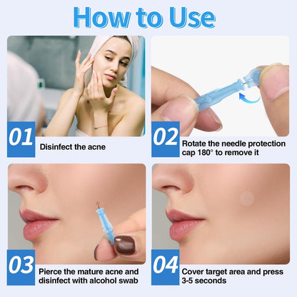 MixS Live Sterile Pimple Needle Kit - 80 Ultra-Fine Acne Needles + 108 Acne Pimple Stickers for Blackhead and Blemish Removal - Clear Skin Solution
