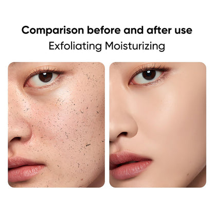 IREV Black Rice Peeling Ampoule – Daily Soft Exfoliating Face Scrub with Charcoal & Rice Extract, Gentle Blackhead Remover & Dead Skin Cells Exfoliator, Lightweight Peel Shot for Smooth Skin, 2.11 Fl Oz
