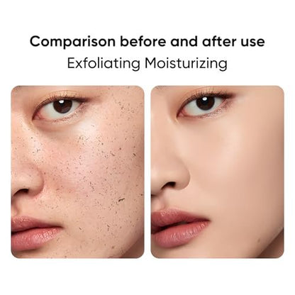 IREV Black Rice Peeling Ampoule – Daily Soft Exfoliating Face Scrub with Charcoal & Rice Extract, Gentle Blackhead Remover & Dead Skin Cells Exfoliator, Lightweight Peel Shot for Smooth Skin, 2.11 Fl Oz