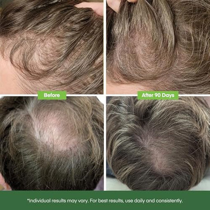 Svvimer Hair Growth Serum Roll On - Rosemary & Batana Oil, Biotin Thickening Scalp Serum for Thinning Hair - for Women and Men, 2 Pack (15ml Each) Avelisse