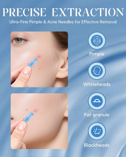 DTTIYXI Pimple Needle 50PCS – Sterile Acne Needle Kit for Blackhead & Blemish Removal, Disposable Extraction Tools for Clear Skin (Home & Salon Use)