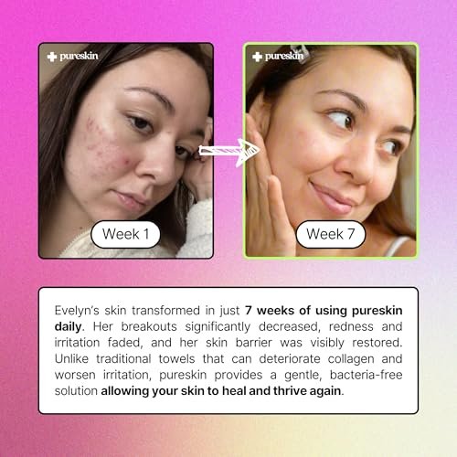 pureskin Daily Clean Facial Towels – 100% Biodegradable Pure Cotton Disposable Face Towels, Ultra Soft, Clinician Recommended, All Skin Types, 50 Count Avelisse