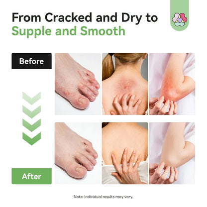 SAVILAND Antifungal Cream - Max Strength 25% Undecylenic Acid, FSA/HSA Eligible, 4.23 oz - Treats Athlete's Foot, Jock Itch, Ringworm with Tea Tree & Oregano Oil Avelisse