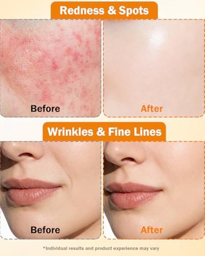 Super Vitamin C Serum for Face | Natural Anti-Aging Formula with Vitamin C, Hyaluronic Acid, Vitamin E & Caffeine – Firming Serum for Hydration, Wrinkle Reduction & Dark Spot Brightening – 1 Fl Oz Avelisse