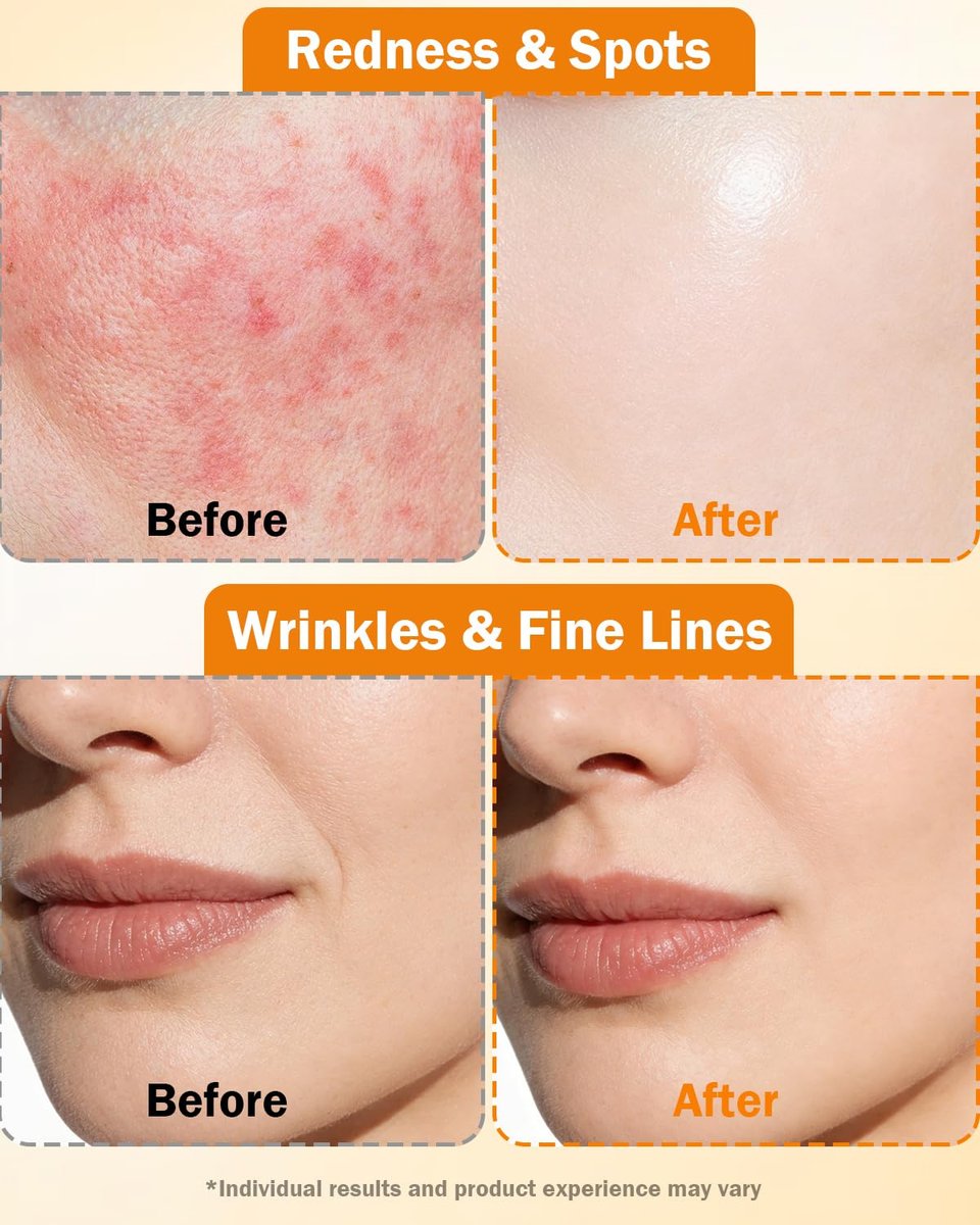 Super Vitamin C Serum for Face | Natural Anti-Aging Formula with Vitamin C, Hyaluronic Acid, Vitamin E & Caffeine – Firming Serum for Hydration, Wrinkle Reduction & Dark Spot Brightening – 1 Fl Oz Avelisse