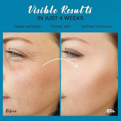 Tighten and Lift Neck Cream: Instant Face Lift Cream - 6-in-1 Anti-Aging Face Moisturizer for Anti-Wrinkle Firm - Collagen Retinol Peptides & Hyaluronic Acid Neck Firming Cream for Skin Care Avelisse