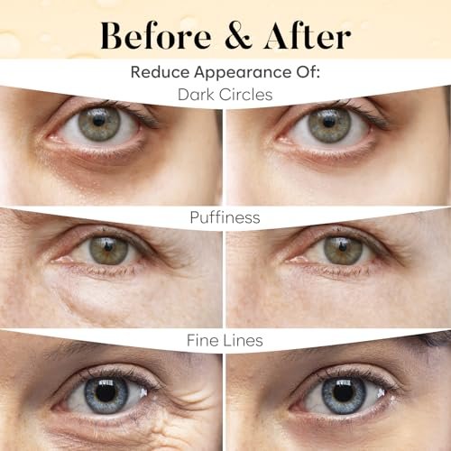 AURAE Vitamin C & Caffeine Under Eye Patches (30 Pairs) – Depuff, Brighten & Hydrate Under Eyes - görsel 8