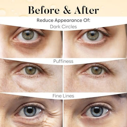 AURAE Vitamin C & Caffeine Under Eye Patches (30 Pairs) – Depuff, Brighten & Hydrate Under Eyes