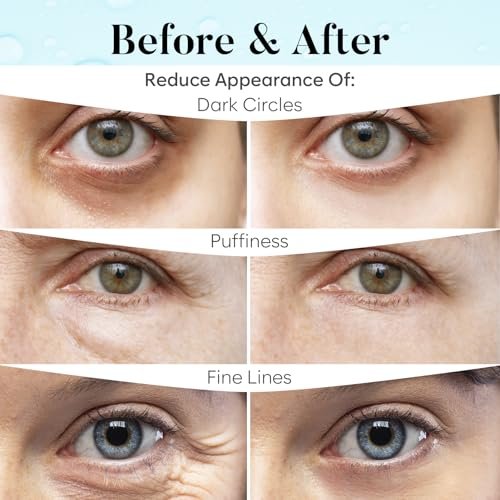AURAE Retinol & Collagen Under Eye Patches (30 Pairs) – Reduce Puffiness, Dark Circles & Fine Lines | Hydrating Eye Mask for Smooth, Bright Eyes - görsel 8