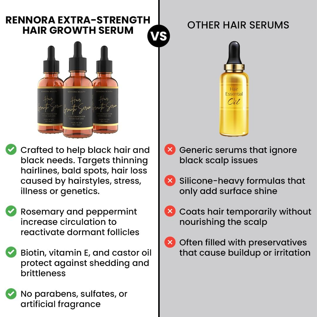 Rennora Extra-Strength Hair Growth Serum with Organic Herbs and Natural Vitamins, Rosemary Oil, Castor Oil, Black Seed, Amla, and Ginseng, No Chemicals, Formulated for Fast Hair Regrowth Avelisse