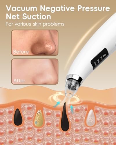 Rechargeable Blackhead Vacuum Pore Cleaner - 5 Attachments & 3 Suction Levels for Deep Facial Cleansing, USB-Powered Blackhead Remover for Women and Men (White) Avelisse