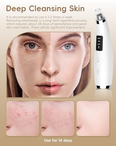 Rechargeable Blackhead Vacuum Pore Cleaner - 5 Attachments & 3 Suction Levels for Deep Facial Cleansing, USB-Powered Blackhead Remover for Women and Men (White) Avelisse
