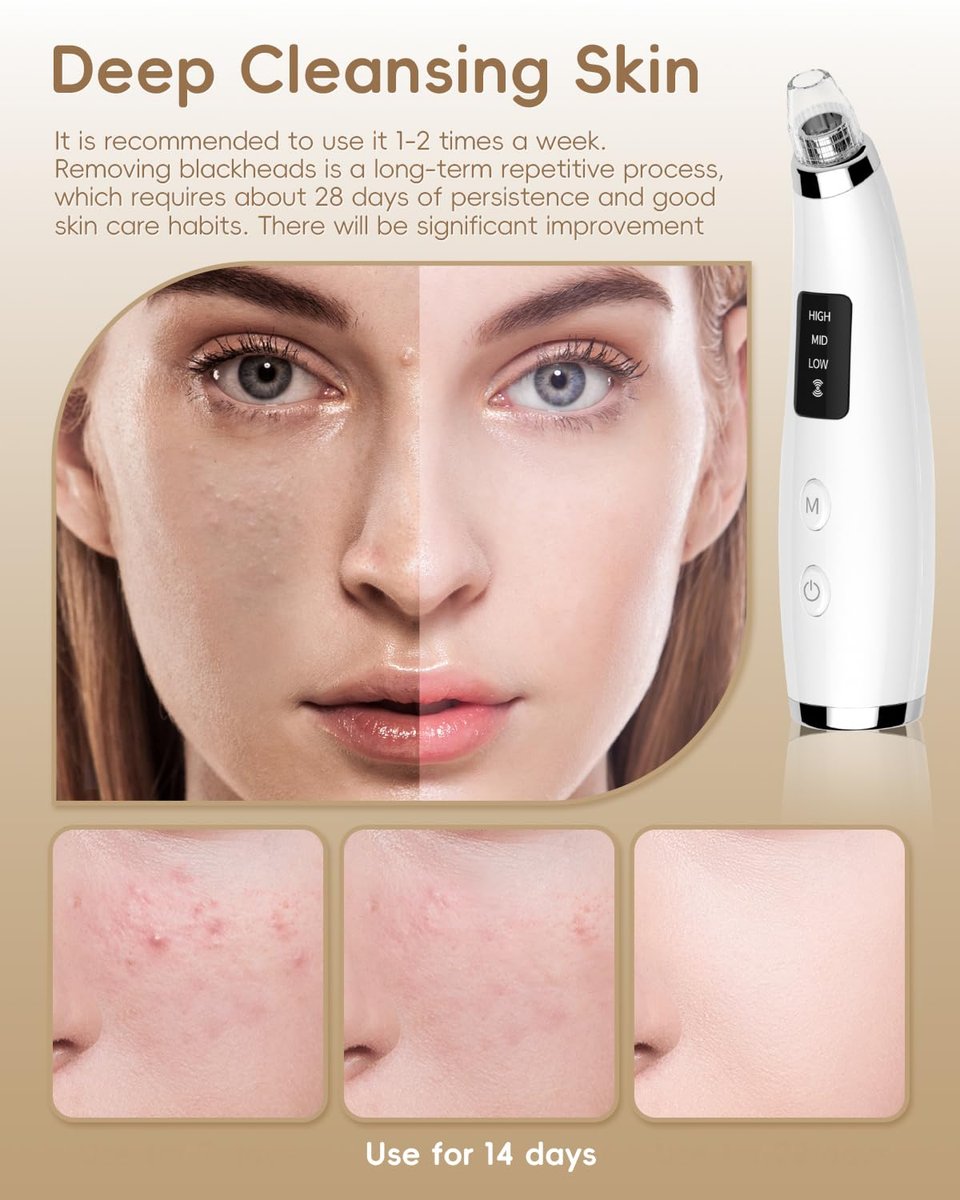 Rechargeable Blackhead Vacuum Pore Cleaner - 5 Attachments & 3 Suction Levels for Deep Facial Cleansing, USB-Powered Blackhead Remover for Women and Men (White) Avelisse