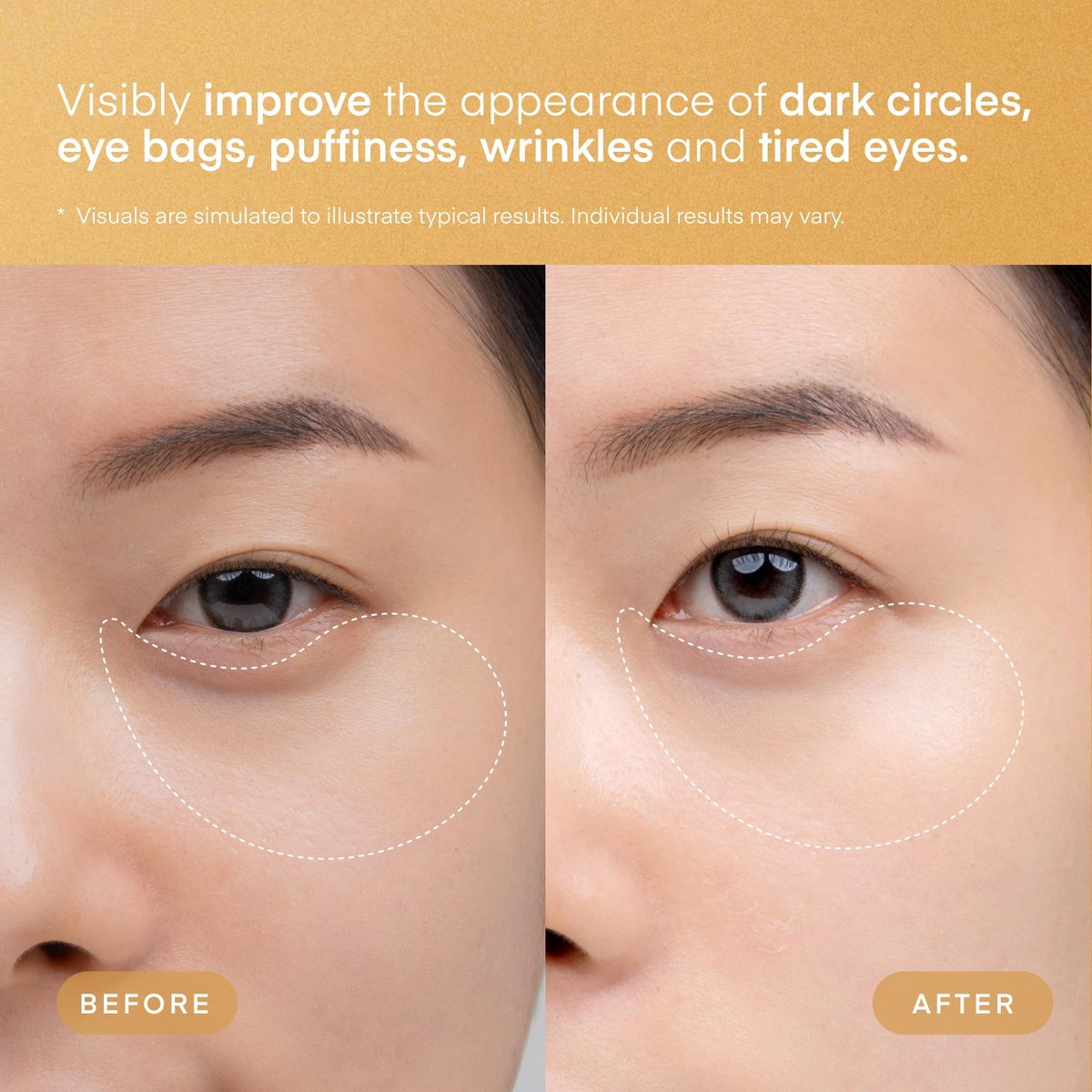 TEREZ & HONOR 24K Gold Retinol Under Eye Patches - 60 Korean Hydrogel Eye Masks with Collagen Peptide for Wrinkles, Dark Circles, Puffy Eyes, Radiance & Firming Avelisse