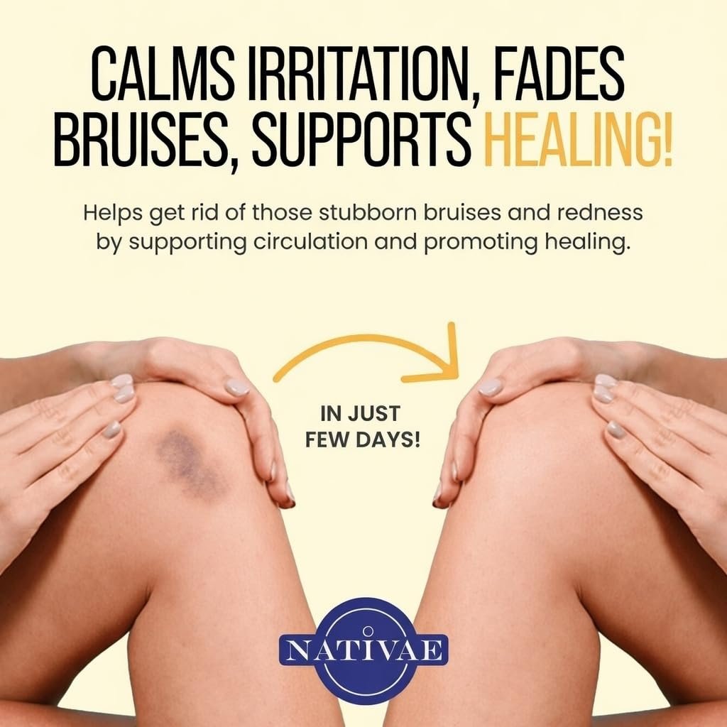 Nativae Helichrysum Balm – Helichrysum Italicum Essential Oil Skin Cream for Bruises, Veins, Burns & Redness – Soothing Healing Moisturizer for Face & Body Avelisse