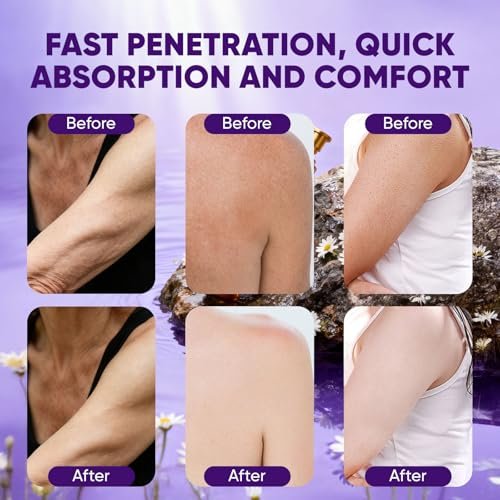Zotreval Body Firming Oil – Luxury Firming & Hydrating Body Serum for Crepe Skin with Vitamin E & Sweet Almond Oil Avelisse