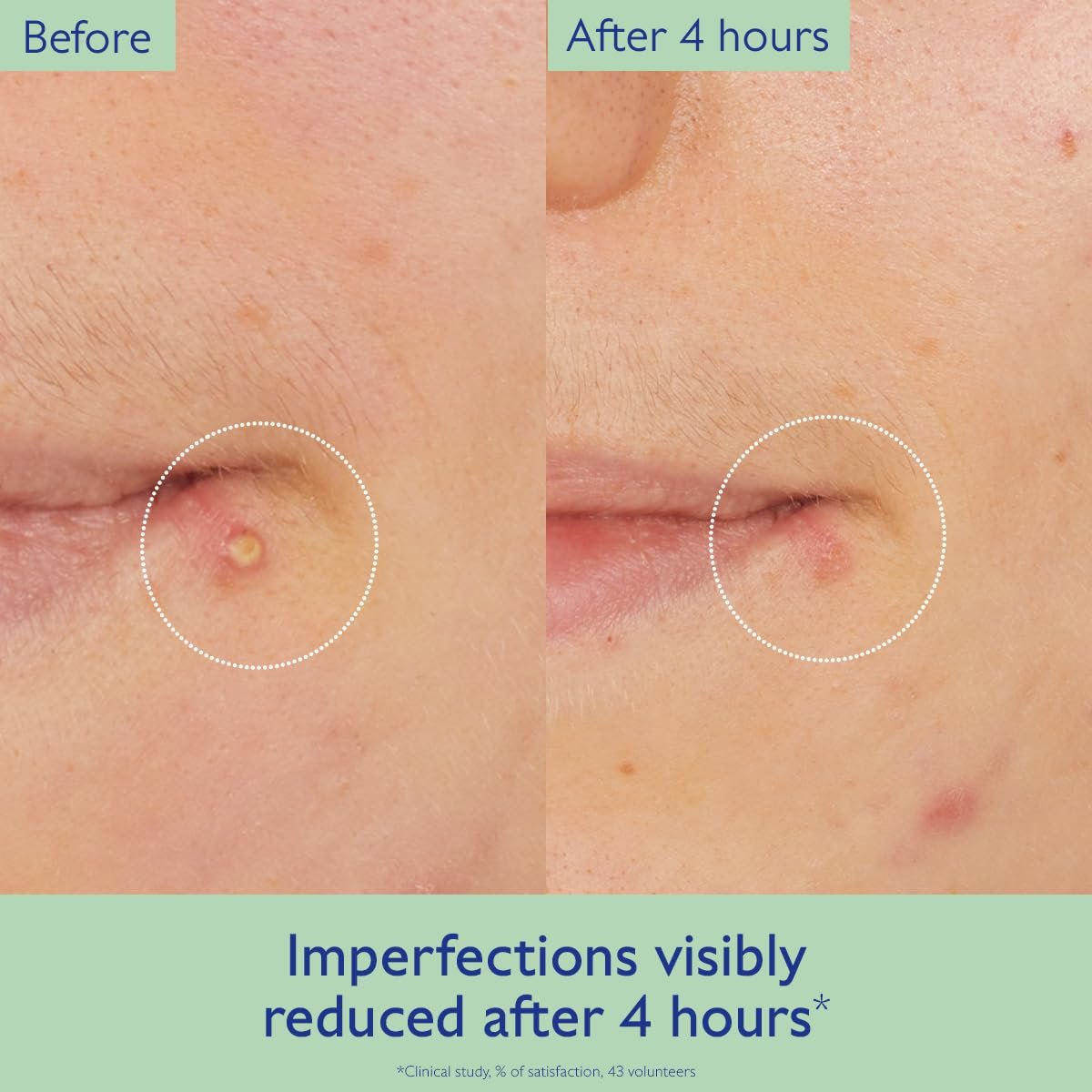 Caudalie Vinopure Targeted Spot Solution with Salicylic Acid - 15 mL Avelisse