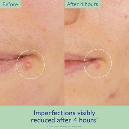 Caudalie Vinopure Targeted Spot Solution with Salicylic Acid - 15 mL Avelisse