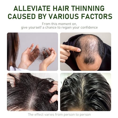 BSAPY Anti Hair Loss Shampoo Bar – DHT Blocker with Polygonum, Ginseng & Tea Tree, Strengthens Roots, Reduces Hair Fall, for Thinning Hair, Herbal Hair Growth Soap 120g *2 Avelisse