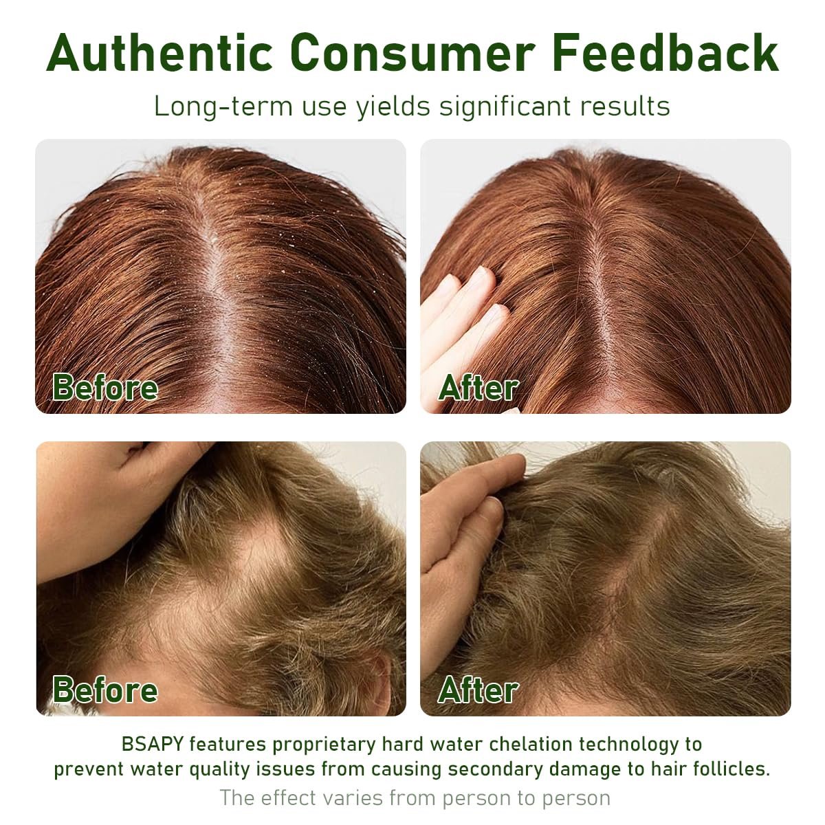 BSAPY Anti Hair Loss Shampoo Bar – DHT Blocker with Polygonum, Ginseng & Tea Tree, Strengthens Roots, Reduces Hair Fall, for Thinning Hair, Herbal Hair Growth Soap 120g *2 Avelisse