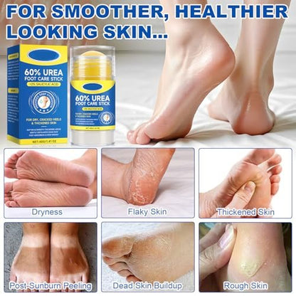 SPRINGSUGAR 60% Urea Foot Cream Stick with 2% Salicylic Acid – Extra-Strength Cracked Heel Repair for Dry Feet & Calluses, Moisturizing Urea Cream Stick for Dead Skin Removal, Heel Balm for Rough Skin (2-Pack) Avelisse