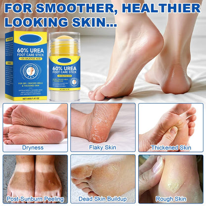 SPRINGSUGAR 60% Urea Foot Cream Stick with 2% Salicylic Acid – Extra-Strength Cracked Heel Repair for Dry Feet & Calluses, Moisturizing Urea Cream Stick for Dead Skin Removal, Heel Balm for Rough Skin (2-Pack) Avelisse