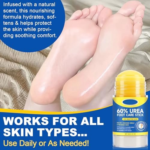 SPRINGSUGAR 60% Urea Foot Cream Stick with 2% Salicylic Acid – Extra-Strength Cracked Heel Repair for Dry Feet & Calluses, Moisturizing Urea Cream Stick for Dead Skin Removal, Heel Balm for Rough Skin (2-Pack) Avelisse