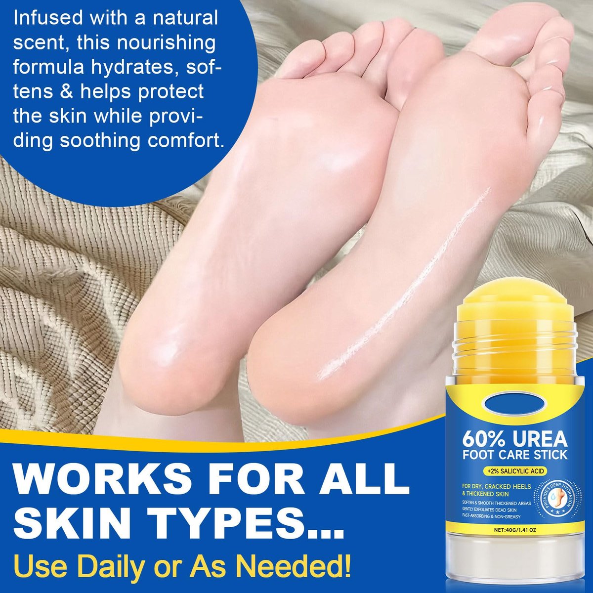SPRINGSUGAR 60% Urea Foot Cream Stick with 2% Salicylic Acid – Extra-Strength Cracked Heel Repair for Dry Feet & Calluses, Moisturizing Urea Cream Stick for Dead Skin Removal, Heel Balm for Rough Skin (2-Pack) Avelisse