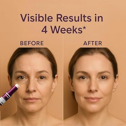VitailQ Anti Wrinkle Calcium Balm – Hydrating Face Moisturizer for Eyes, Neck, and Face Avelisse