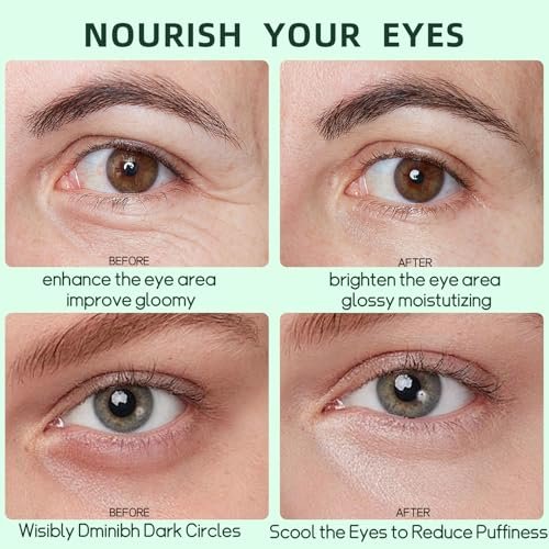 Avocado Eye Mask 60 Pcs - Hydrating Under Eye Patches for Dark Circles, Puffiness, and Fine Lines - görsel 10