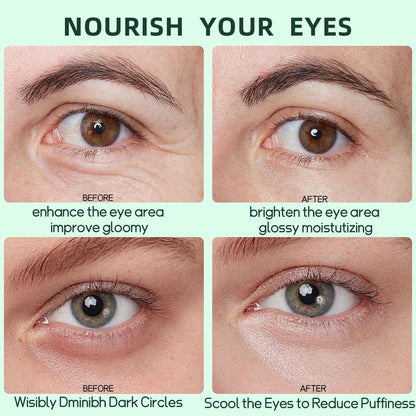 Avocado Eye Mask 60 Pcs - Hydrating Under Eye Patches for Dark Circles, Puffiness, and Fine Lines