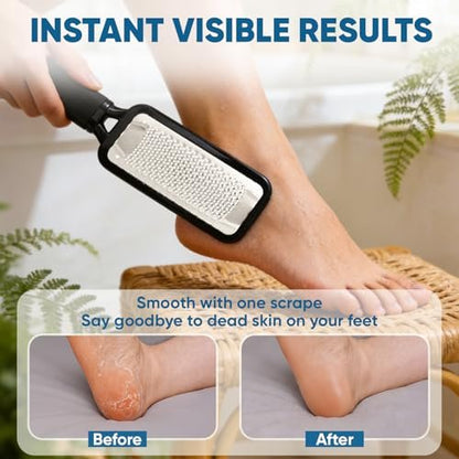 TEAWOO Foot File Callus Remover - Large Stainless Steel Foot Rasp, Heavy Duty Foot Scraper for Dead Skin & Hard Heels, Waterproof Pedicure Tool for At-Home Foot Care