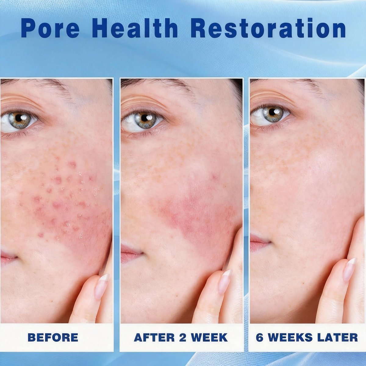 2 PCS Azelaic Acid Cream for Face - Moisturizer with Hyaluronic Acid for Redness, Acne Breakouts, and Oil Balance - görsel 5