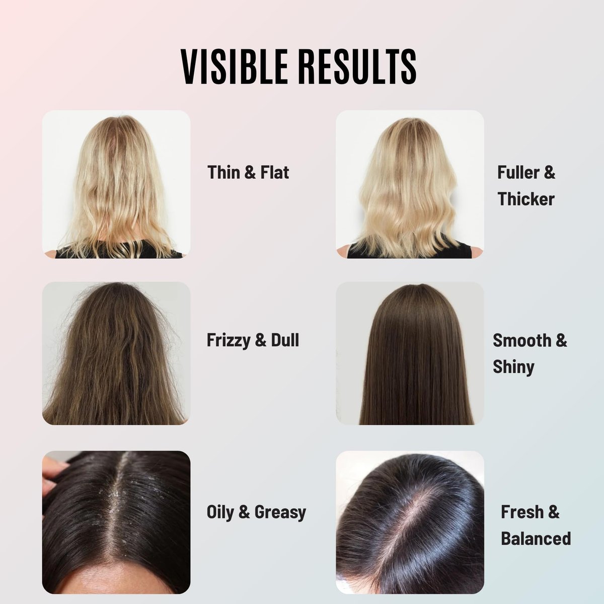 Tricholoy+ Volumizing & Thickening Shampoo and Conditioner Set - Biotin Root Lift Formula for Fine, Thin Hair - Adds Fullness, Weightless Hydration & Scalp Care, Sulfate-Free, 10 Fl Oz Avelisse
