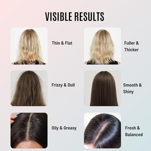 Tricholoy+ Volumizing & Thickening Shampoo and Conditioner Set - Biotin Root Lift Formula for Fine, Thin Hair - Adds Fullness, Weightless Hydration & Scalp Care, Sulfate-Free, 10 Fl Oz Avelisse