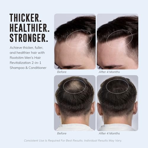 DHT Blocking Shampoo for Men - Hair Thickening & Anti Hair Loss Shampoo with Saw Palmetto, Biotin & Rosemary - 2-in-1, Sulfate-Free, 10oz Avelisse