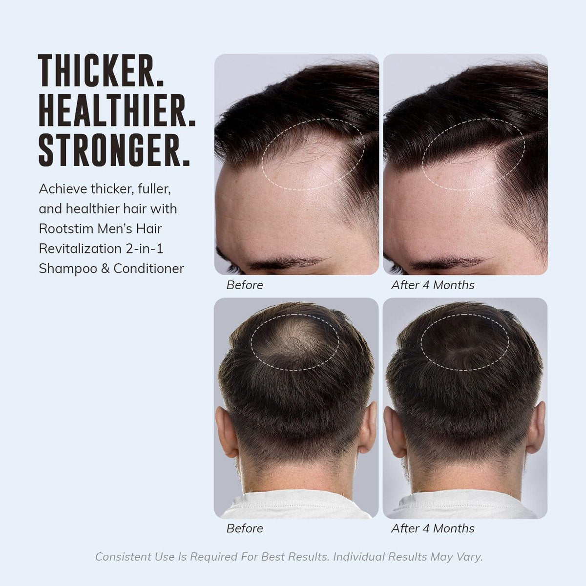 DHT Blocking Shampoo for Men - Hair Thickening & Anti Hair Loss Shampoo with Saw Palmetto, Biotin & Rosemary - 2-in-1, Sulfate-Free, 10oz Avelisse