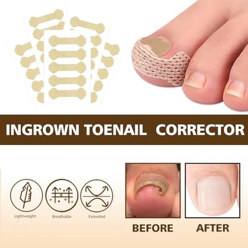 Ingrown Toenail Corrector Set with Magnifier and Correction Strips – Professional Treatment Tools for Safe Home Nail Care Avelisse