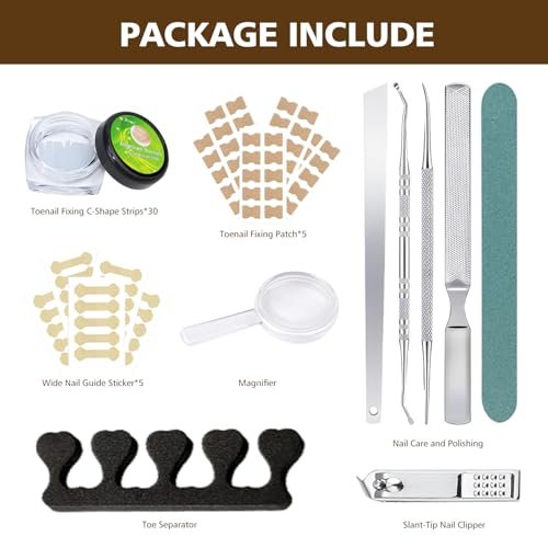 Ingrown Toenail Corrector Set with Magnifier and Correction Strips – Professional Treatment Tools for Safe Home Nail Care Avelisse