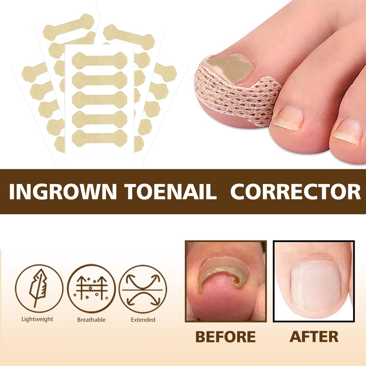 Ingrown Toenail Corrector Set with Magnifier and Correction Strips – Professional Treatment Tools for Safe Home Nail Care Avelisse