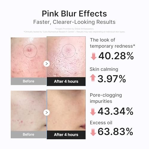 medicube 3H Overnight Drying Lotion - Targeted Spot Care for Troubled & Oily-Prone Skin, Calming & Soothing with Calamine, Centella & Tea Tree, Korean Skincare 20ml Avelisse