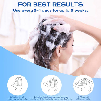 FYZMTL Anti-Dandruff Shampoo - Anti-Fungal Scalp Treatment for Folliculitis, Seborrheic Dermatitis & Scalp Psoriasis, Itchy Scalp Relief & Hydrating Dry Scalp Care for Men & Women (6.75 Fl Oz)