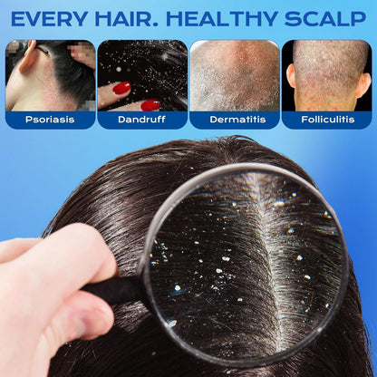 FYZMTL Anti-Dandruff Shampoo - Anti-Fungal Scalp Treatment for Folliculitis, Seborrheic Dermatitis & Scalp Psoriasis, Itchy Scalp Relief & Hydrating Dry Scalp Care for Men & Women (6.75 Fl Oz)