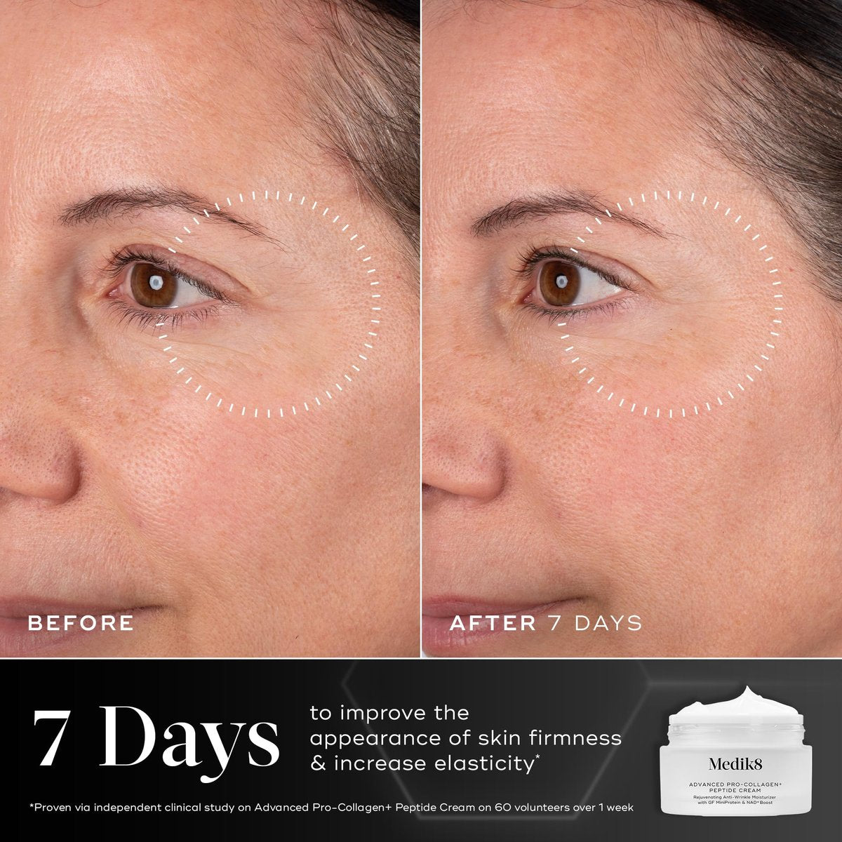 Medik8 Advanced Pro Collagen Peptide Cream - Daily Face Moisturizer for Dry Skin - Lifting Moisturizer Face Cream with Anti-Aging Peptides - 1.6 oz Avelisse