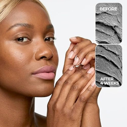 Nail Repair Pen for Damaged, Brittle & Thin Nails — Post-Acrylic & Gel Damage Treatment with Keratin, Peptides, Hyaluronic Acid & Niacinamide — Dermatologist Tested, 45-Day Supply by nakeyNails Avelisse