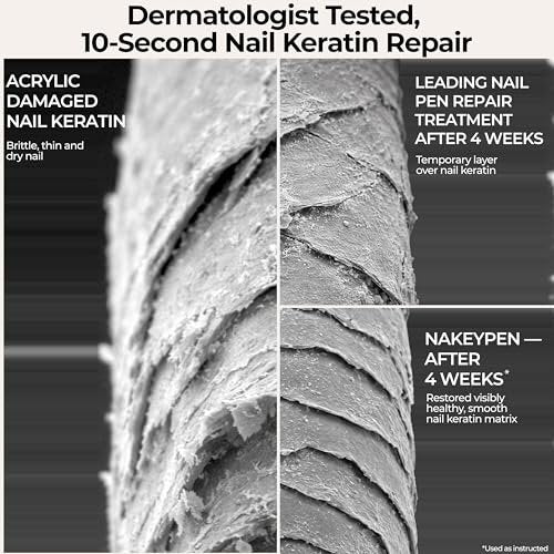 Nail Repair Pen for Damaged, Brittle & Thin Nails — Post-Acrylic & Gel Damage Treatment with Keratin, Peptides, Hyaluronic Acid & Niacinamide — Dermatologist Tested, 45-Day Supply by nakeyNails Avelisse