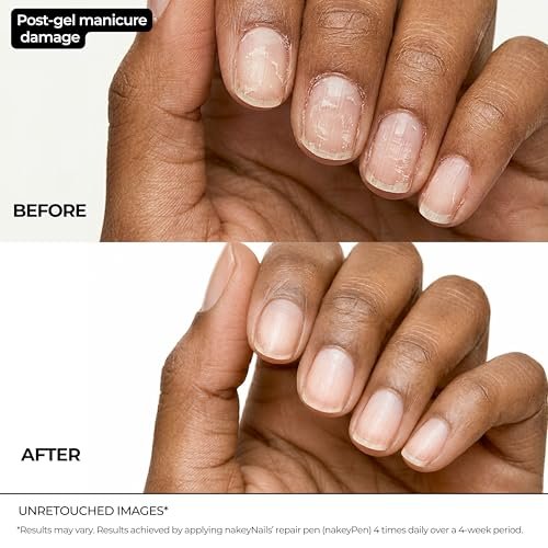 Nail Repair Pen for Damaged, Brittle & Thin Nails — Post-Acrylic & Gel Damage Treatment with Keratin, Peptides, Hyaluronic Acid & Niacinamide — Dermatologist Tested, 45-Day Supply by nakeyNails Avelisse