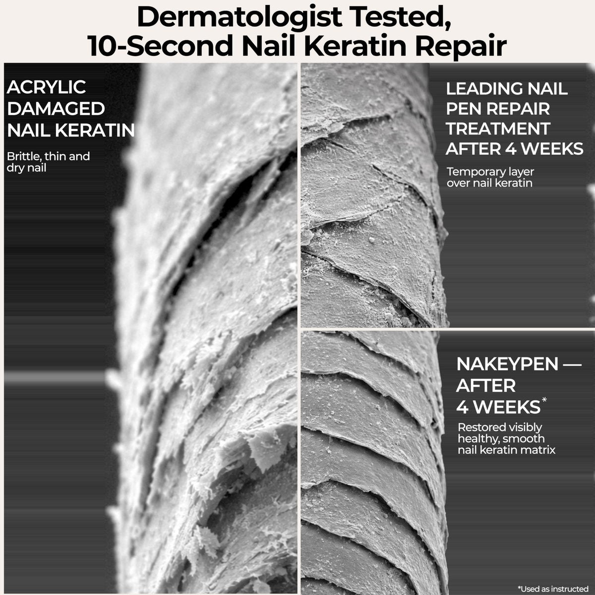 Nail Repair Pen for Damaged, Brittle & Thin Nails — Post-Acrylic & Gel Damage Treatment with Keratin, Peptides, Hyaluronic Acid & Niacinamide — Dermatologist Tested, 45-Day Supply by nakeyNails Avelisse