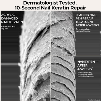 Nail Repair Pen for Damaged, Brittle & Thin Nails — Post-Acrylic & Gel Damage Treatment with Keratin, Peptides, Hyaluronic Acid & Niacinamide — Dermatologist Tested, 45-Day Supply by nakeyNails Avelisse