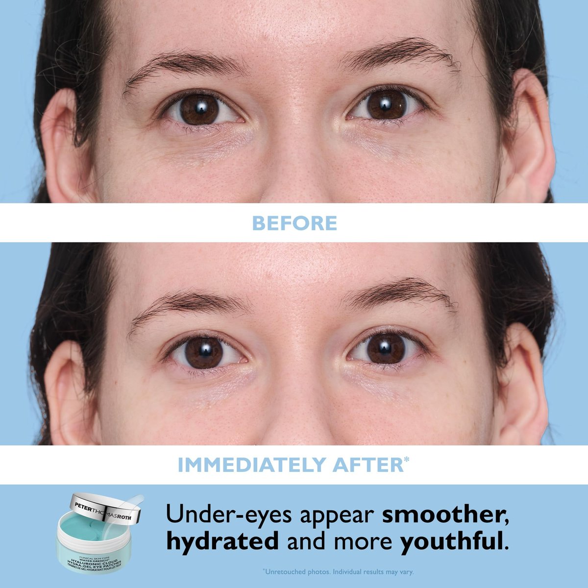 Peter Thomas Roth Water Drench® Essentials 2-Piece Face & Eye Kit – Hyaluronic Acid Moisturizer & Eye Masks Avelisse